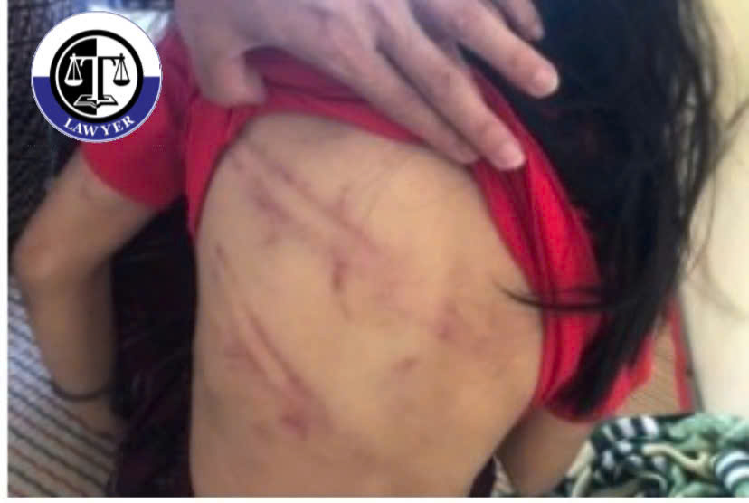 Khởi tố gã cha dượng dùng gậy gỗ, búa đinh đánh đập bé gái ở Hà Tĩnh